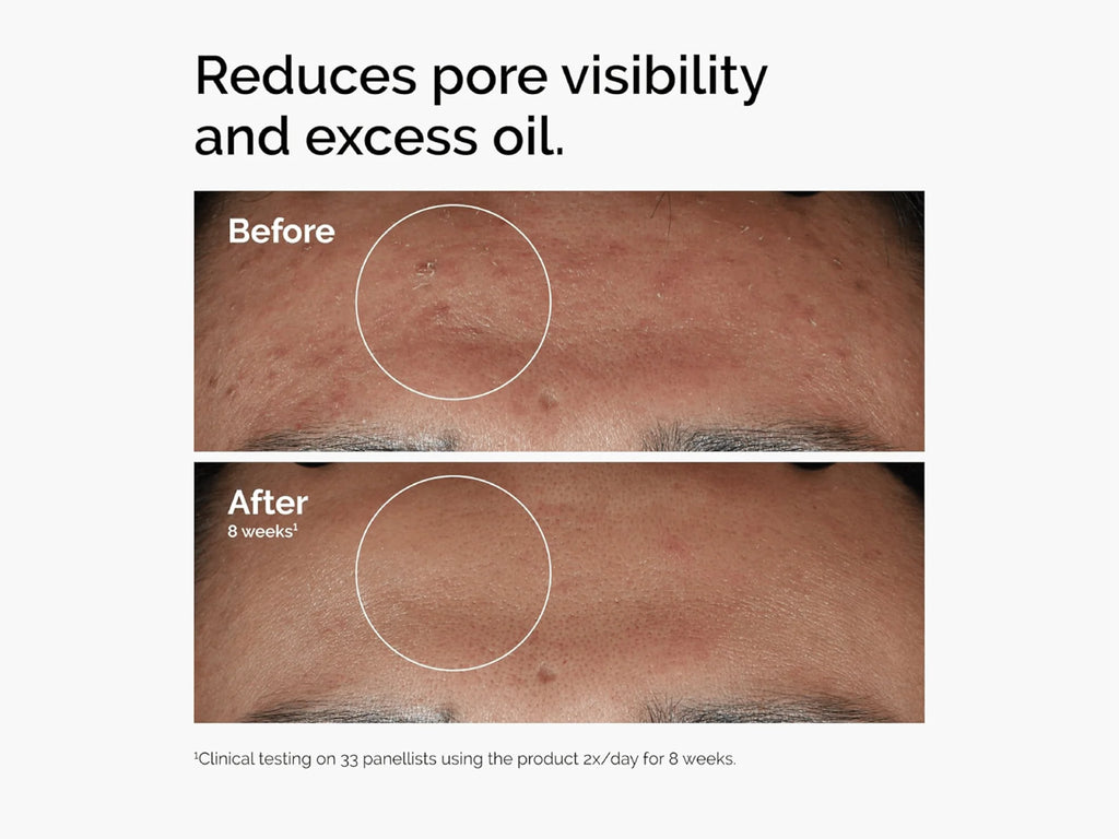 The Ordinary Niacinamide 10% + ZINC 1% 60ml