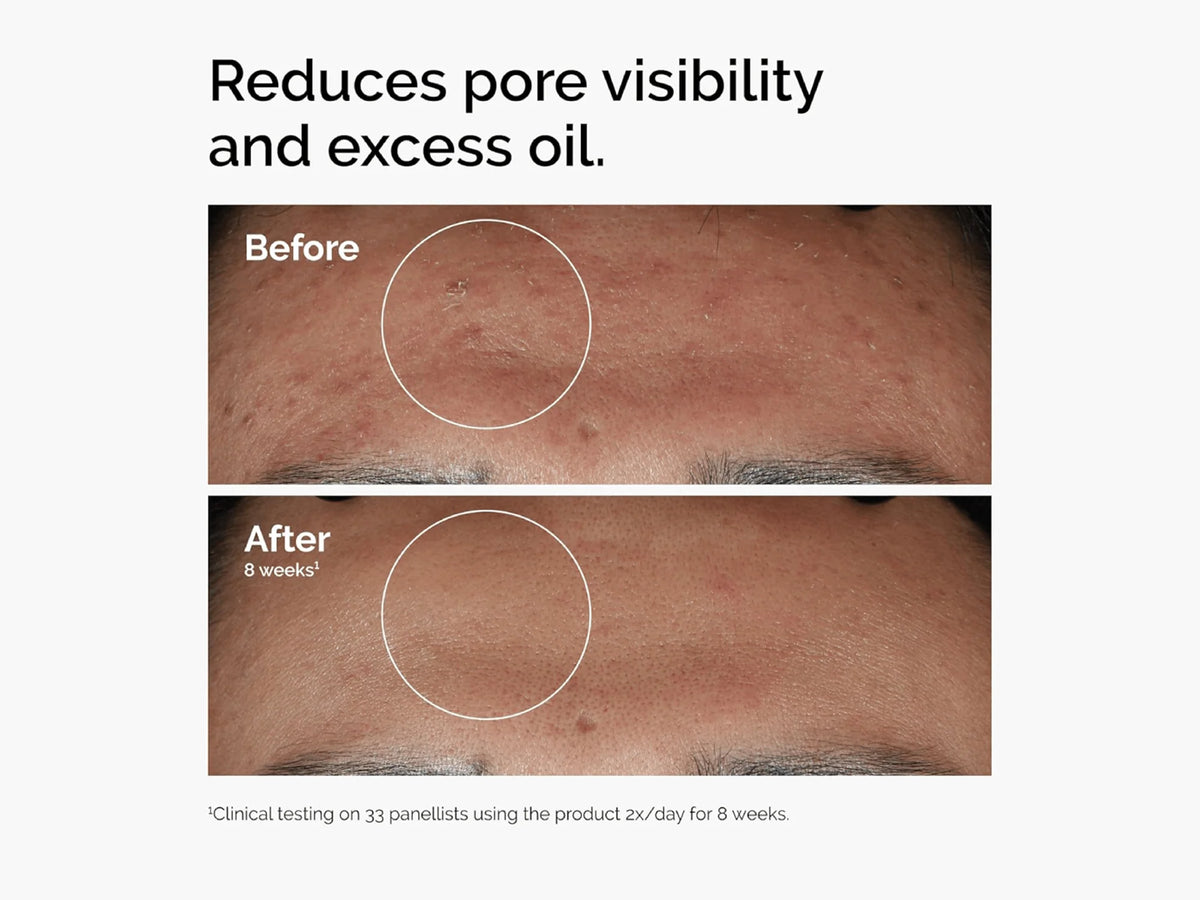 The Ordinary Niacinamide 10% + ZINC 1% 60ml
