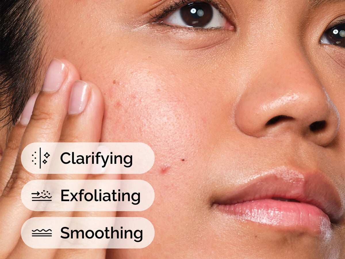 The Ordinary Salicylic Acid 2% Solution 30ml-Canada